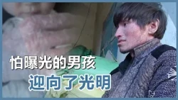 蛇皮人生蛻變重生｜慈濟60｜慈濟充滿愛｜20261002